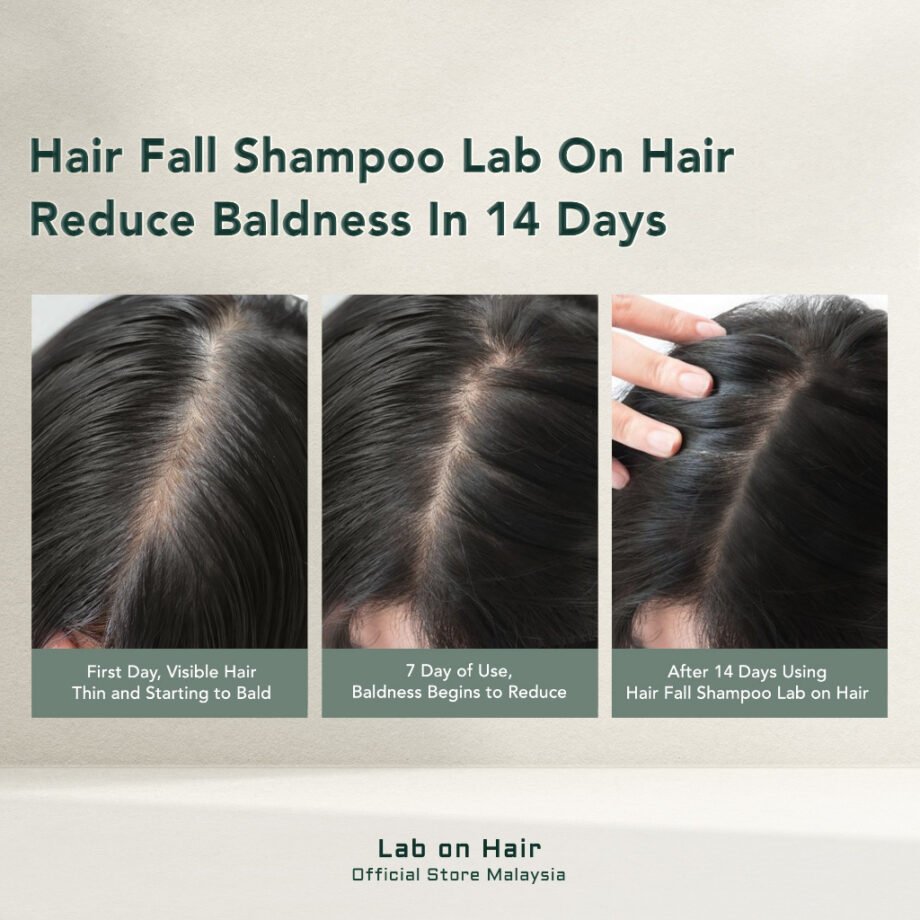 Lab On Hair 2 Pcs HairFall Control Shampoo - Root Booster Syampo for Hair Growth with Redensyl Syampu